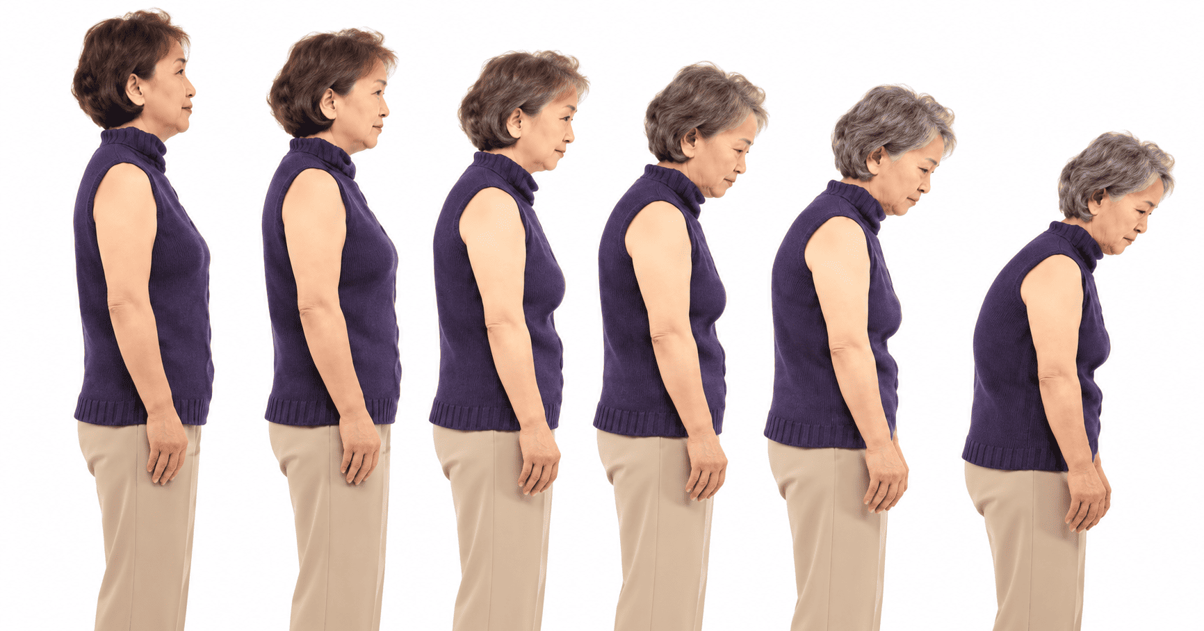 Tanda dan Gejala Osteoporosis yang Perlu Dikenali