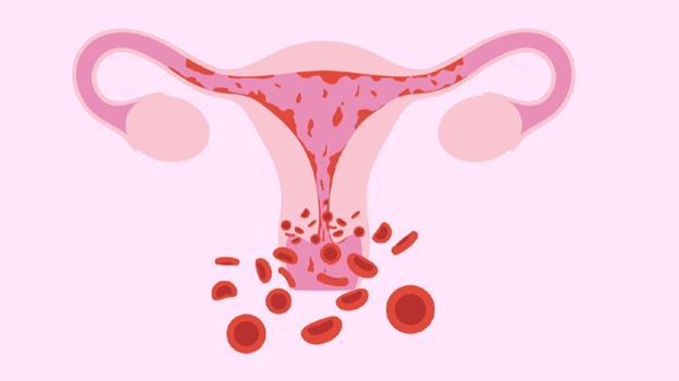 Harus Apa Jika Menstruasi Tidak Lancar? Kenali 7 Faktor Risiko, Penyebab, & Cara Pencegahannya!