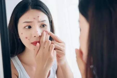 Gejala PCOS yang Perlu Dikenali