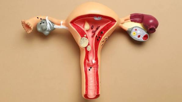Harus Apa Jika Menstruasi Tidak Lancar? Kenali 7 Faktor Risiko, Penyebab, & Cara Pencegahannya!